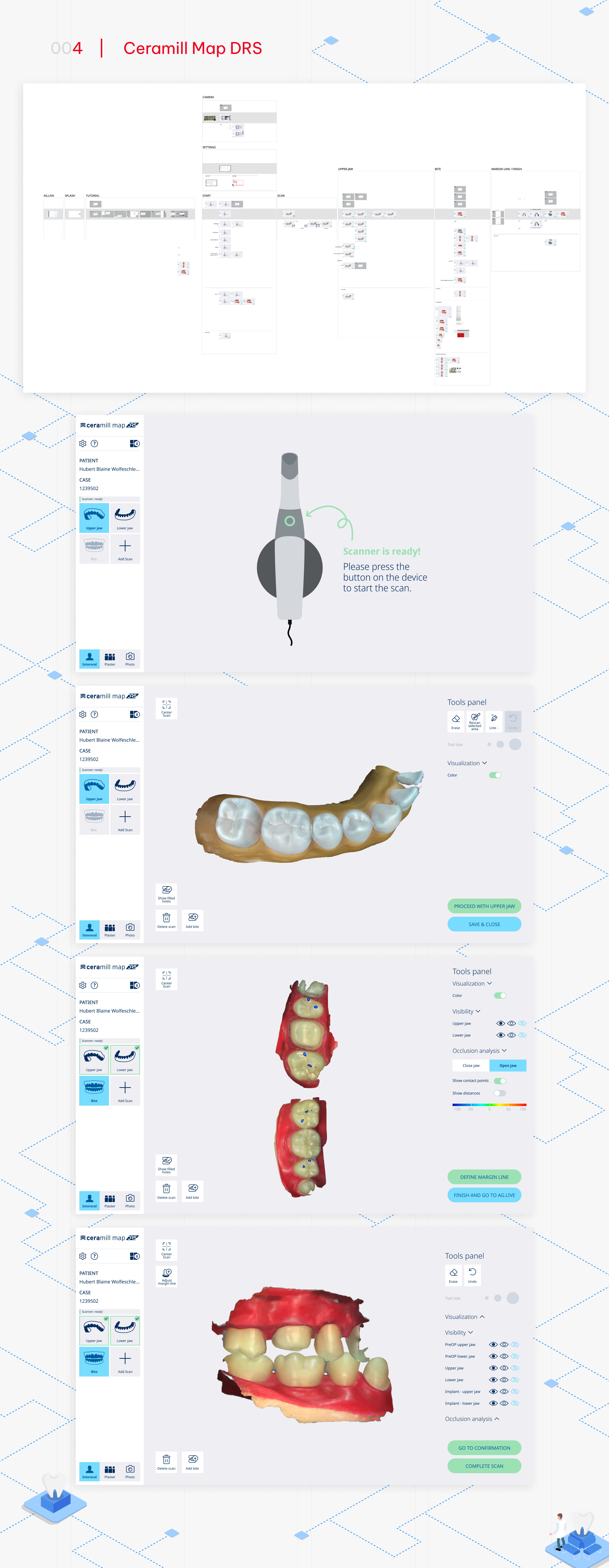 Amann Girrbach - Ceramill Map DRS